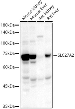 ABclonal Technology&nbsp;SLC27A2 Rabbit pAb