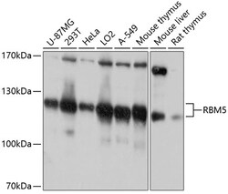 ABclonal Technology&nbsp;RBM5 Rabbit pAb