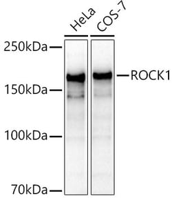 ABclonal Technology&nbsp;[KO Validated] ROCK1 Rabbit pAb