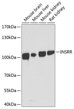 ABclonal Technology&nbsp;INSRR Rabbit pAb