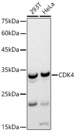 ABclonal Technology&nbsp;CDK4 Rabbit pAb