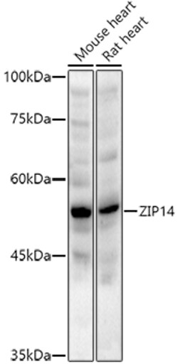 ABclonal Technology&nbsp;ZIP14 Rabbit pAb