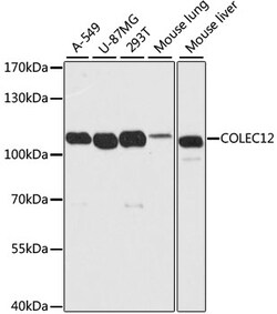 ABclonal Technology&nbsp;COLEC12 Rabbit pAb