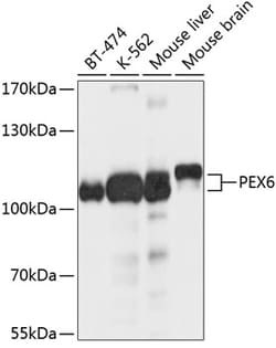 ABclonal Technology&nbsp;PEX6 Rabbit pAb