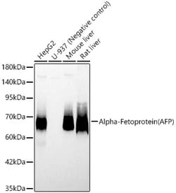 ABclonal Technology&nbsp;Alpha-Fetoprotein (AFP) Rabbit pAb