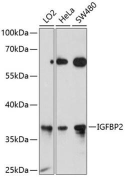 ABclonal Technology&nbsp;IGFBP2 Rabbit pAb