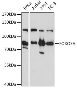 ABclonal Technology&nbsp;FOXO3A Rabbit pAb