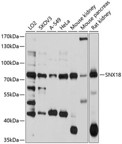 ABclonal Technology&nbsp;SNX18 Rabbit pAb