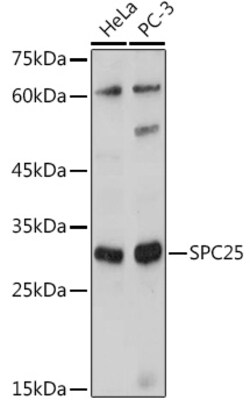 ABclonal Technology&nbsp;SPC25 Rabbit pAb