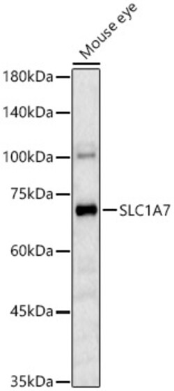 ABclonal Technology&nbsp;SLC1A7 Rabbit pAb