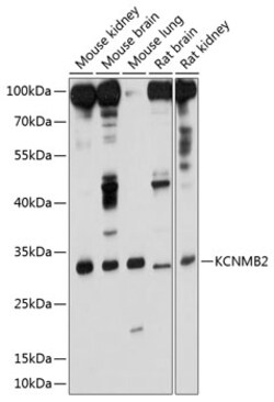 ABclonal Technology&nbsp;KCNMB2 Rabbit pAb