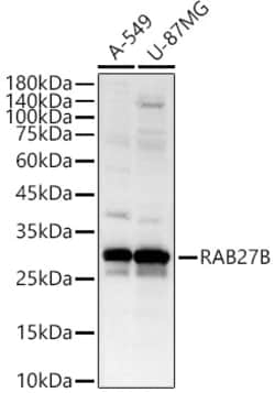 ABclonal Technology&nbsp;RAB27B Rabbit pAb