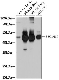 ABclonal Technology&nbsp;SEC14L2 Rabbit pAb