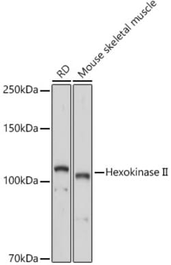 ABclonal Technology&nbsp;Hexokinase II Rabbit pAb