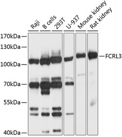 ABclonal Technology&nbsp;FCRL3 Rabbit pAb