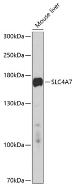 ABclonal Technology&nbsp;SLC4A7 Rabbit pAb