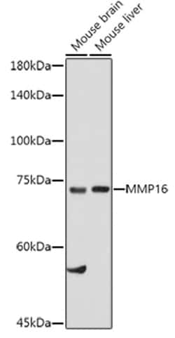 ABclonal Technology&nbsp;MMP16 Rabbit pAb