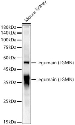 ABclonal Technology&nbsp;Legumain (LGMN) Rabbit pAb