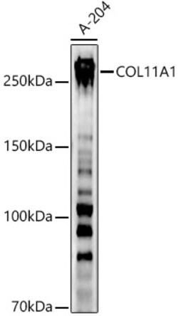 ABclonal Technology&nbsp;COL11A1 Rabbit pAb