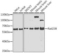 ABclonal Technology&nbsp;Rad23B Rabbit pAb
