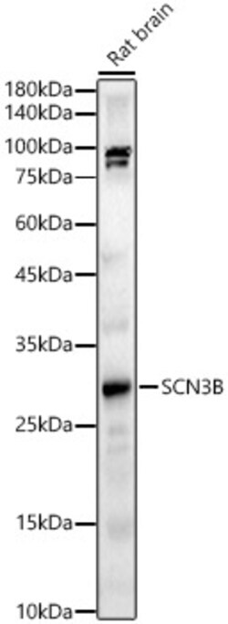 ABclonal Technology&nbsp;SCN3B Rabbit pAb