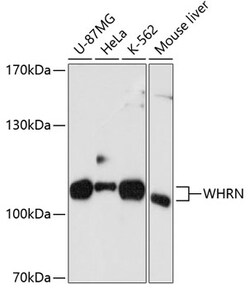 ABclonal Technology&nbsp;WHRN Rabbit pAb