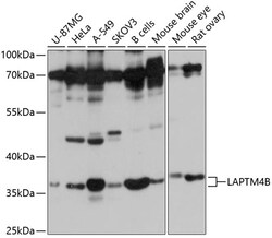 ABclonal Technology&nbsp;LAPTM4B Rabbit pAb