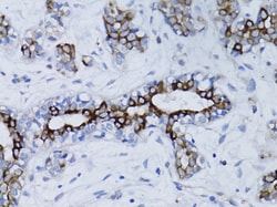 ABclonal Technology&nbsp;BRCA1 Rabbit pAb
