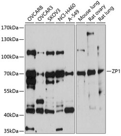ABclonal Technology&nbsp;ZP1 Rabbit pAb