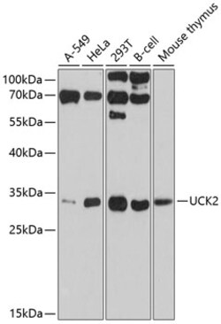 ABclonal Technology&nbsp;UCK2 Rabbit pAb