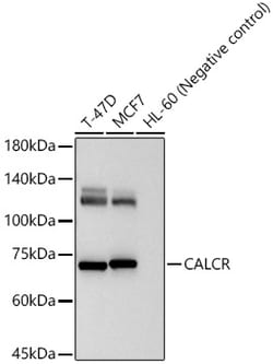 ABclonal Technology&nbsp;CALCR Rabbit pAb