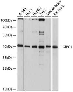ABclonal Technology&nbsp;GIPC1 Rabbit pAb