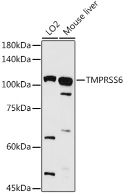 ABclonal Technology&nbsp;TMPRSS6 Rabbit pAb