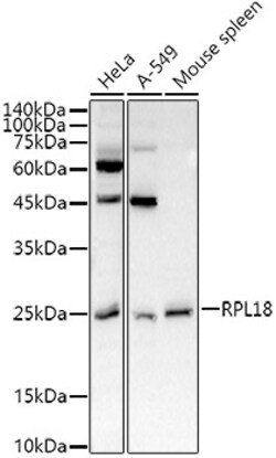 ABclonal Technology&nbsp;RPL18 Rabbit pAb