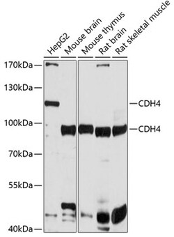 ABclonal Technology&nbsp;CDH4 Rabbit pAb