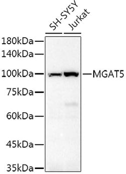 ABclonal Technology&nbsp;GNT-V/MGAT5 Rabbit pAb