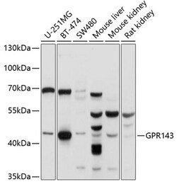 ABclonal Technology&nbsp;GPR143 Rabbit pAb