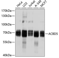 ABclonal Technology&nbsp;ACBD5 Rabbit pAb