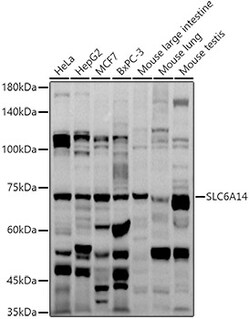 ABclonal Technology&nbsp;SLC6A14 Rabbit pAb