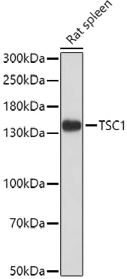 ABclonal Technology&nbsp;TSC1 Rabbit pAb