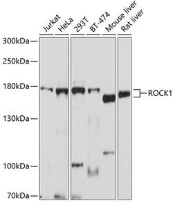 ABclonal Technology&nbsp;ROCK1 Rabbit pAb