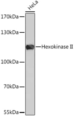 ABclonal Technology&nbsp;Hexokinase II Rabbit pAb