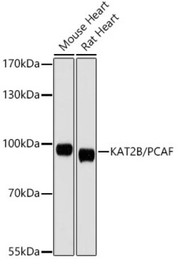 ABclonal Technology&nbsp;KAT2B/PCAF Rabbit pAb