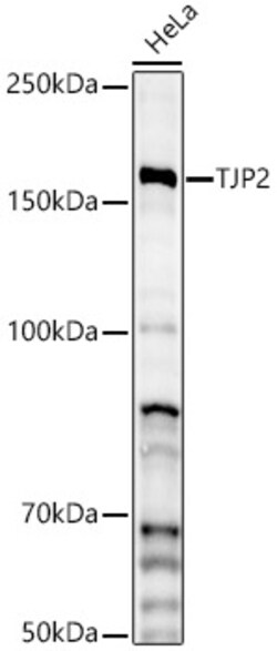 ABclonal Technology&nbsp;TJP2 Rabbit pAb