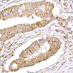 ABclonal Technology&nbsp;ATG7 Rabbit pAb