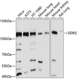 ABclonal Technology&nbsp;DDR2 Rabbit pAb