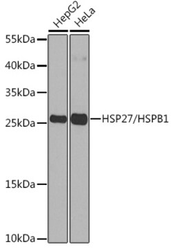 ABclonal Technology&nbsp;HSP27/HSPB1 Rabbit pAb