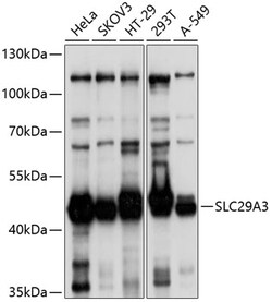 ABclonal Technology&nbsp;SLC29A3 Rabbit pAb