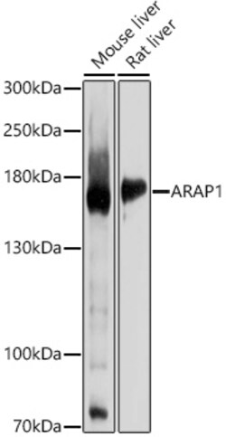 ABclonal Technology&nbsp;ARAP1 Rabbit pAb