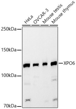 ABclonal Technology&nbsp;XPO6 Rabbit pAb